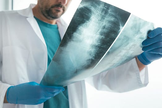 Spinal X-ray being reviewed for back injury lawyer